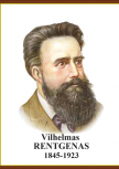 rentgenas_1646903274-7edb33ce794e15776ca008580b6879a6.png